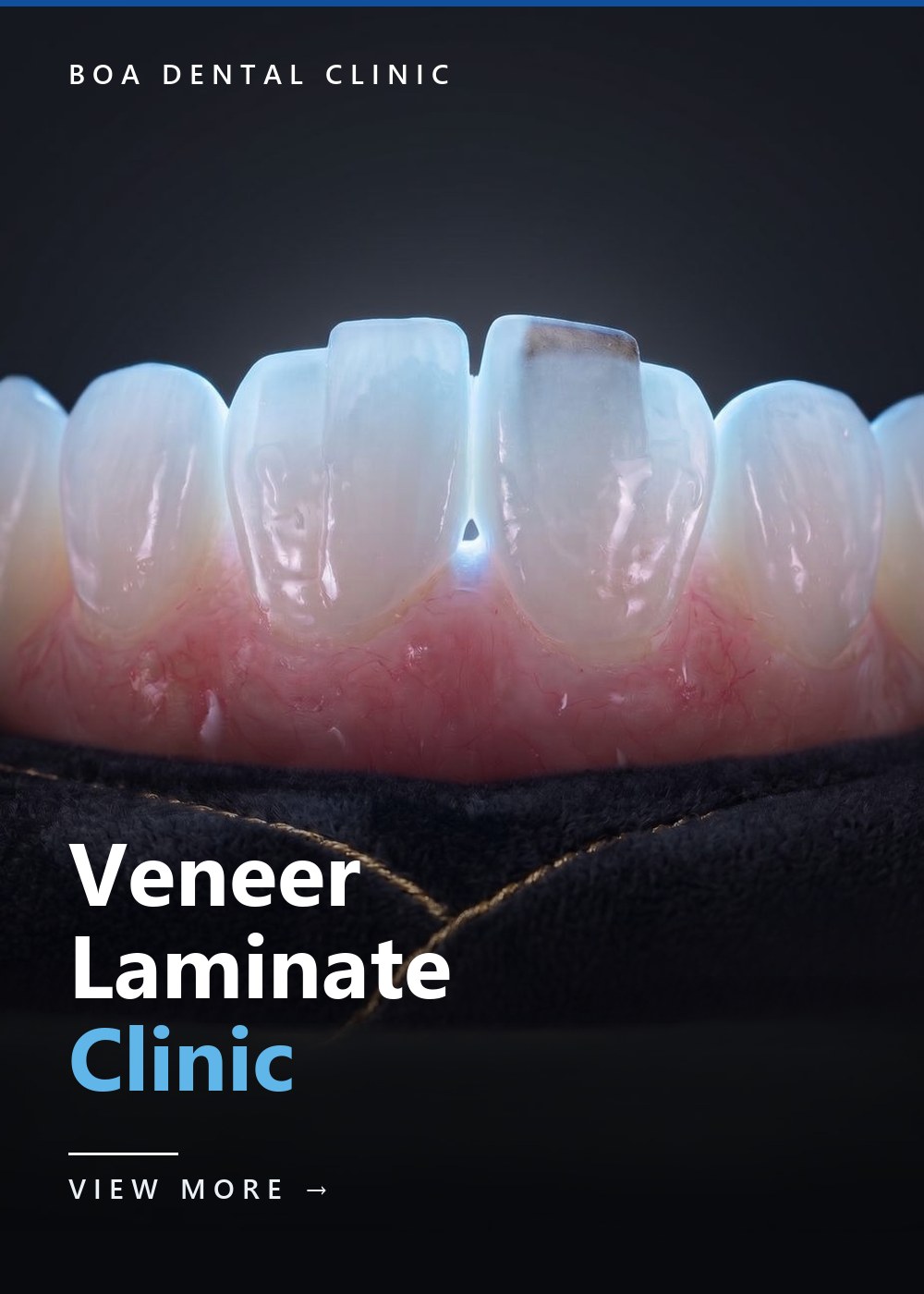BOA Veneer Laminate Clinic